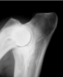 Elbow radiograph